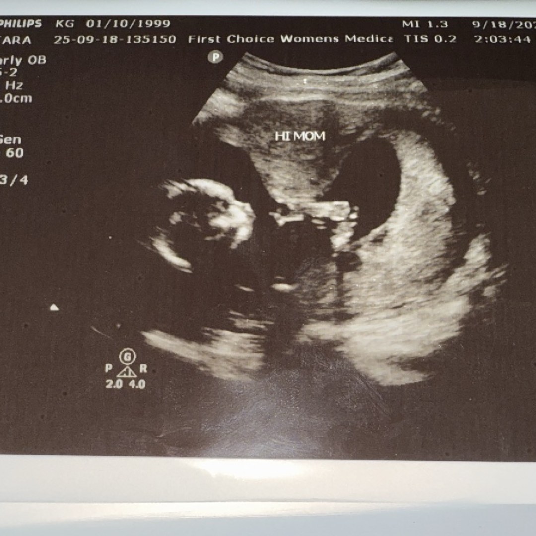 Photo shared by KaNiesha for their Babylist baby registry.