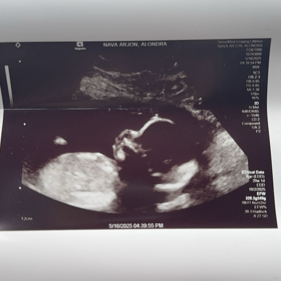 Photo shared by Alondra for their Babylist baby registry.