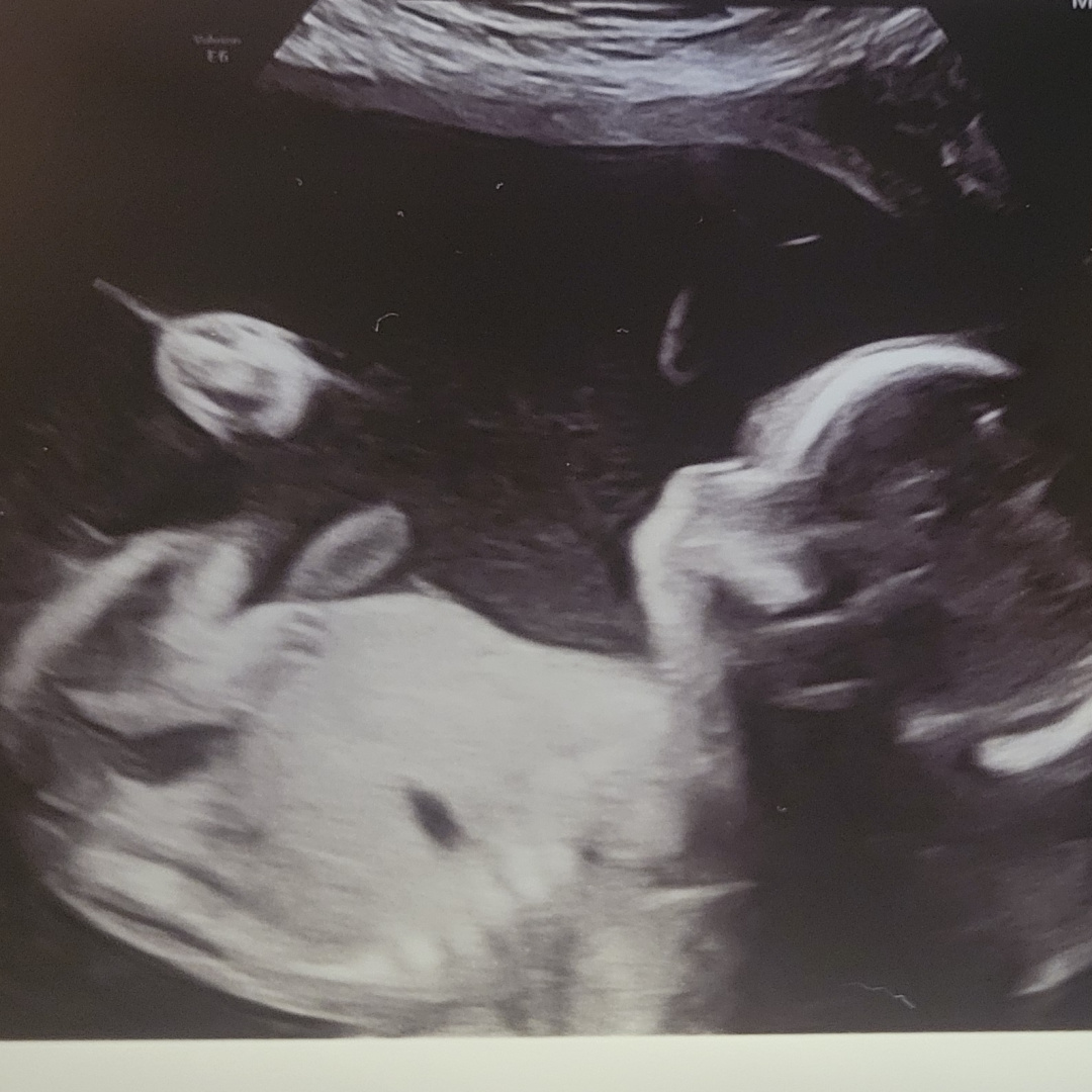 Photo shared by Christina for their Babylist baby registry.