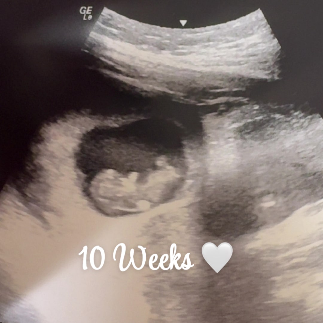 Photo shared by Cassie for their Babylist baby registry.