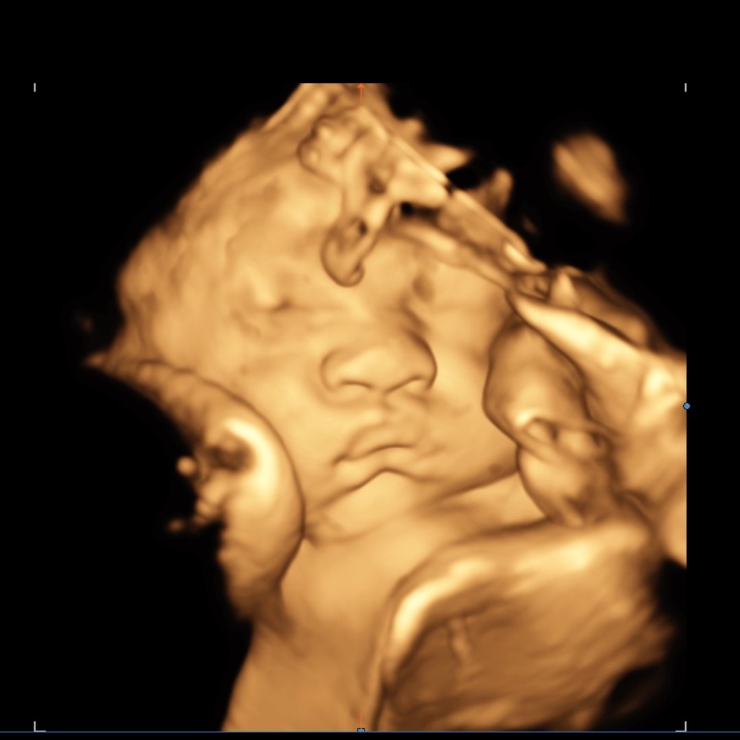 Photo shared by Brianna for their Babylist baby registry.