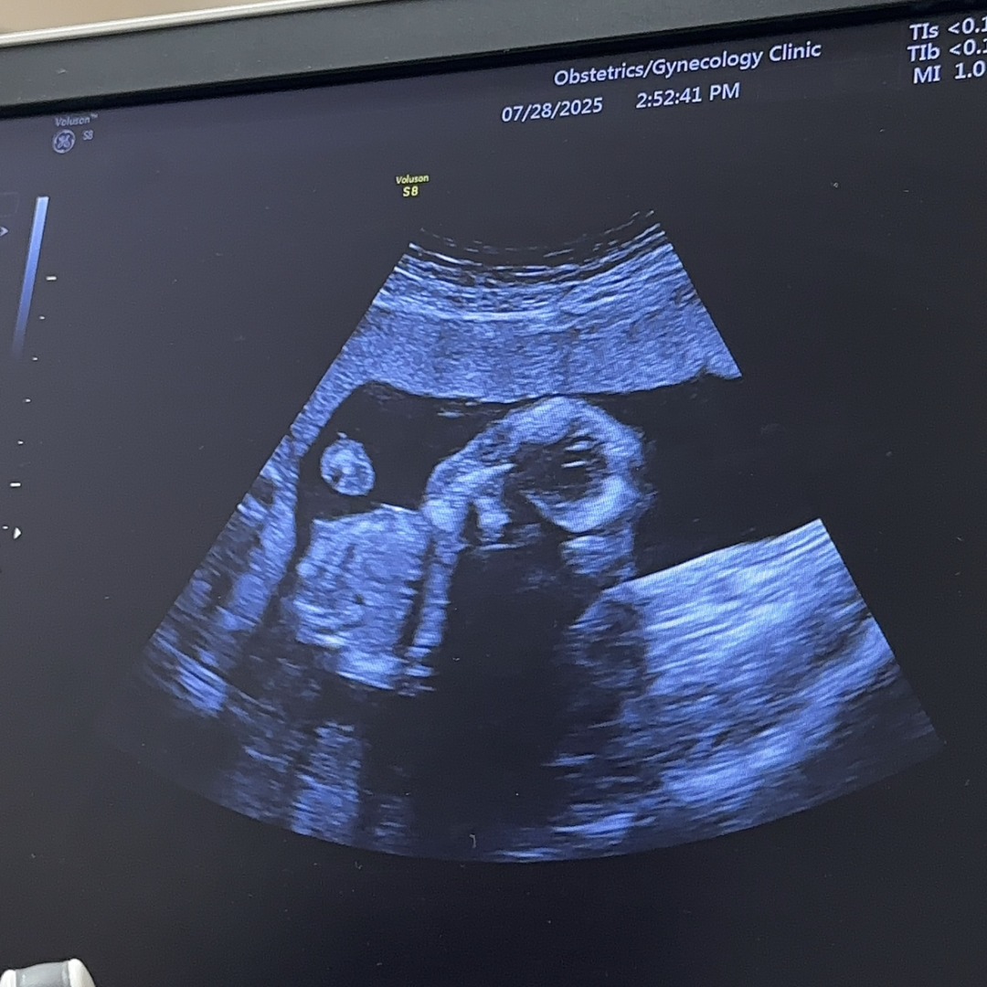 Photo shared by Natalie for their Babylist baby registry.