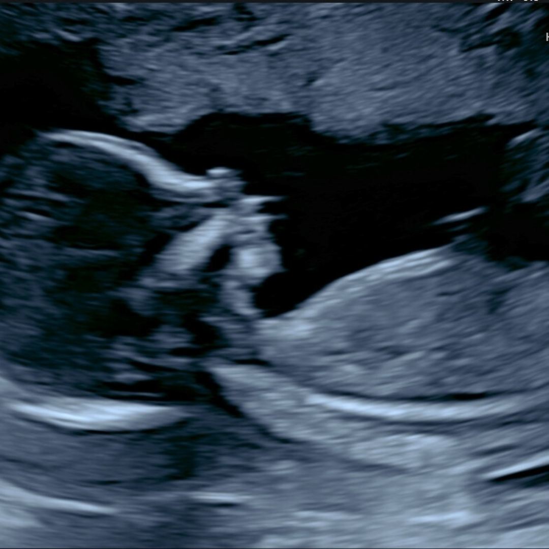 Photo shared by Oneeka for their Babylist baby registry.