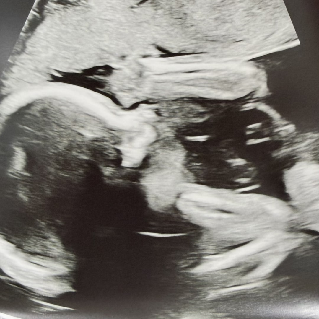 Photo shared by Samantha for their Babylist baby registry.