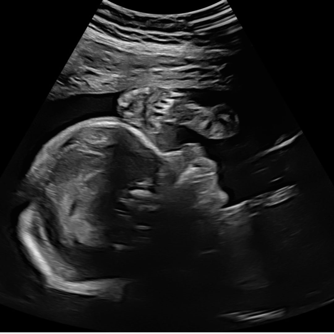 Photo shared by Ashley for their Babylist baby registry.