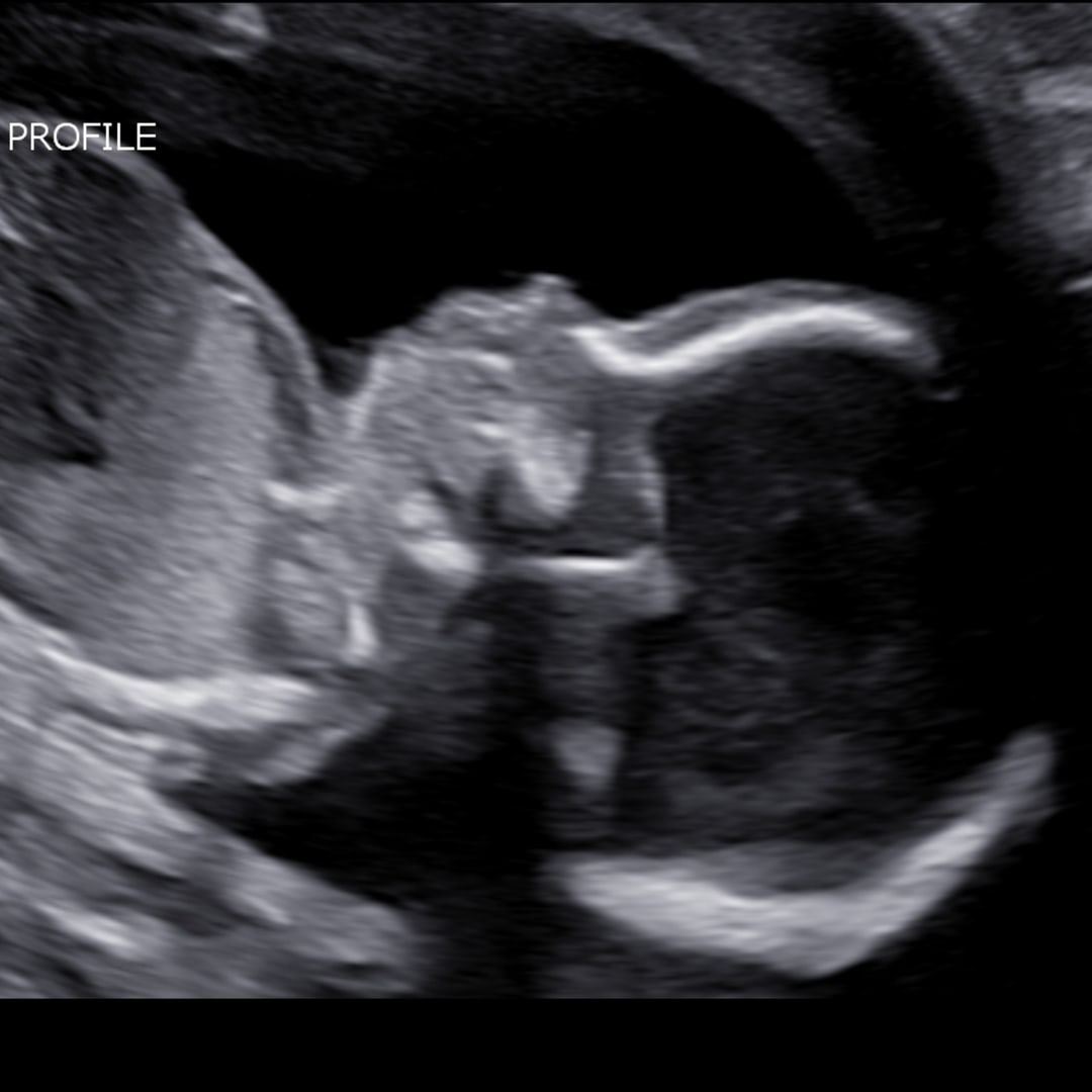 Photo shared by Mary for their Babylist baby registry.
