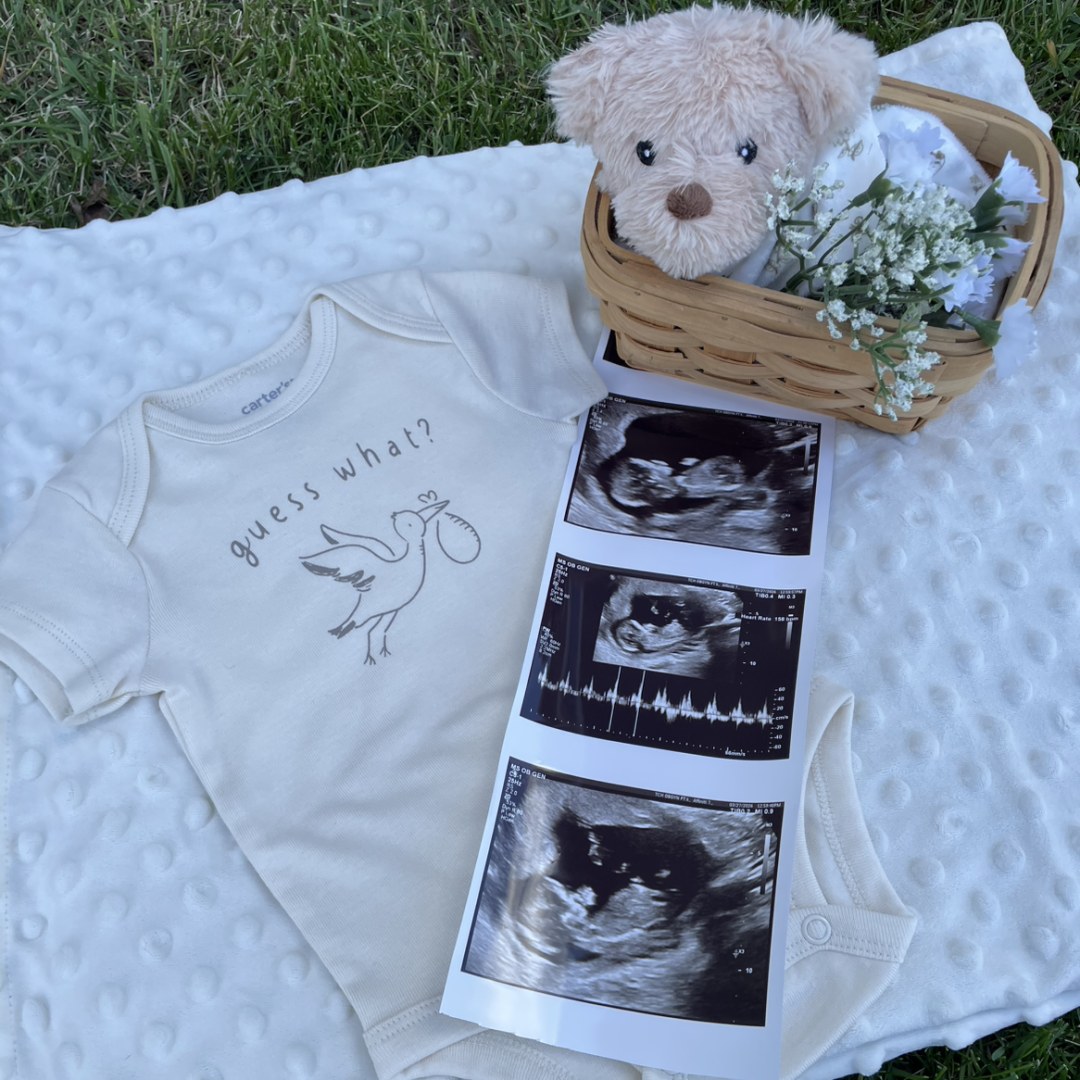 Photo shared by Gavin & Emma for their Babylist baby registry.