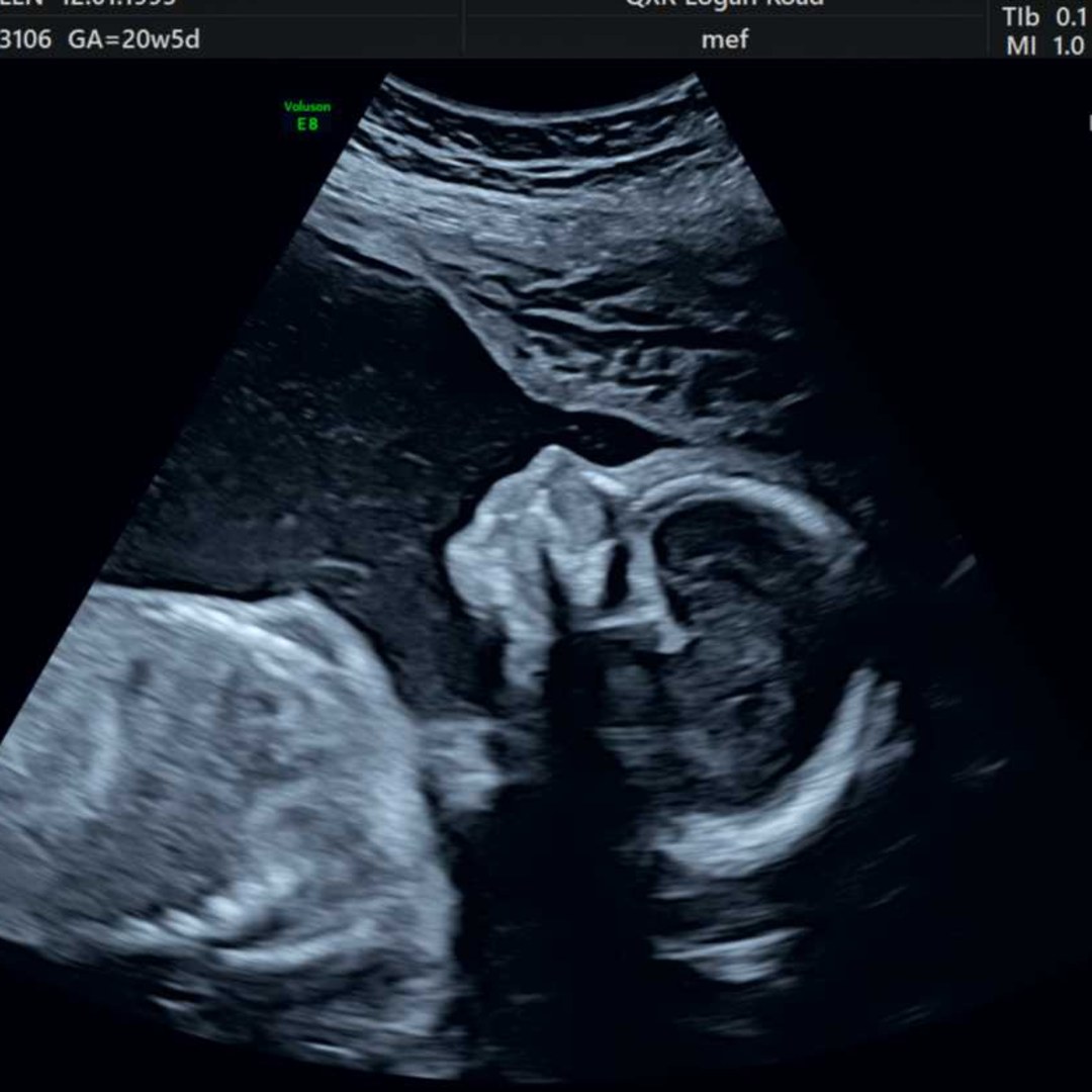 Photo shared by Ellen for their Babylist baby registry.