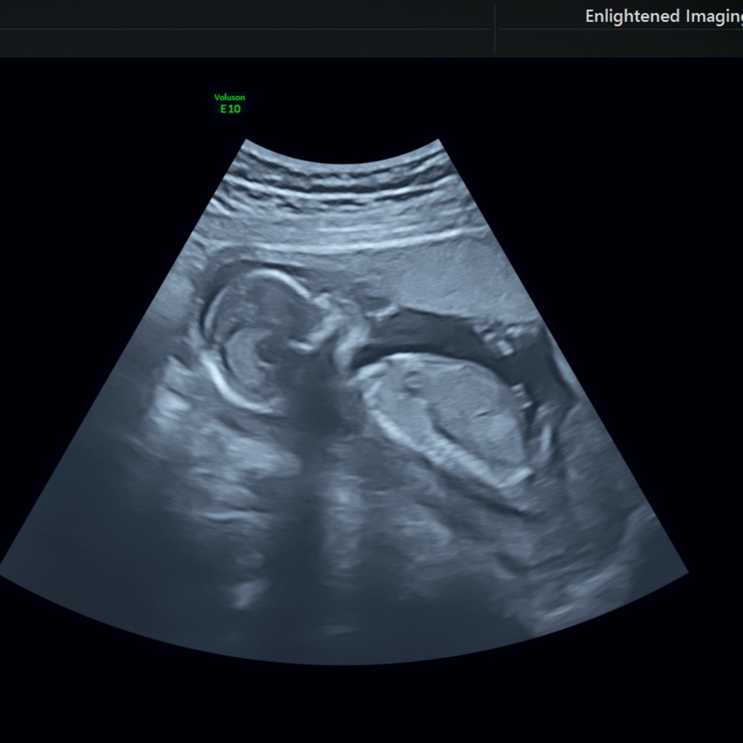 Photo shared by Kaylynn for their Babylist baby registry.