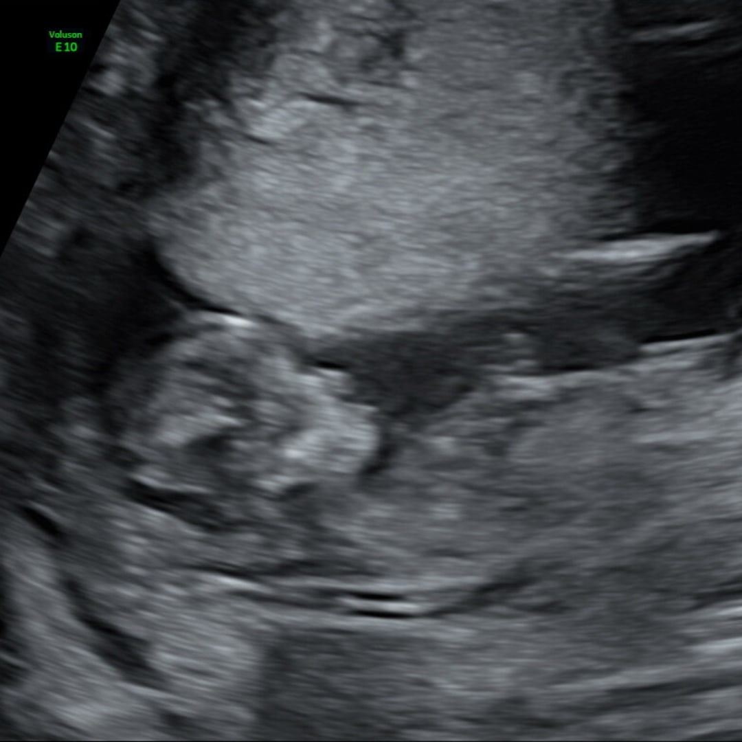 Photo shared by Hannah for their Babylist baby registry.