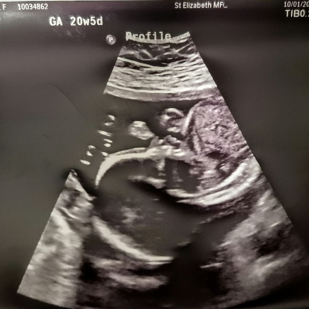 Photo shared by Nicci for their Babylist baby registry.
