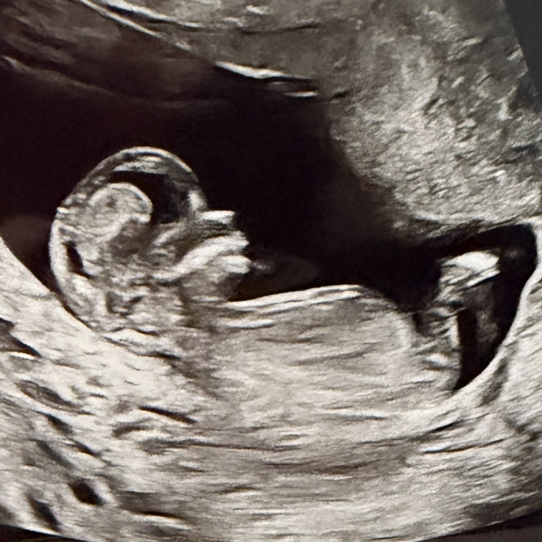 Photo shared by Bria for their Babylist baby registry.