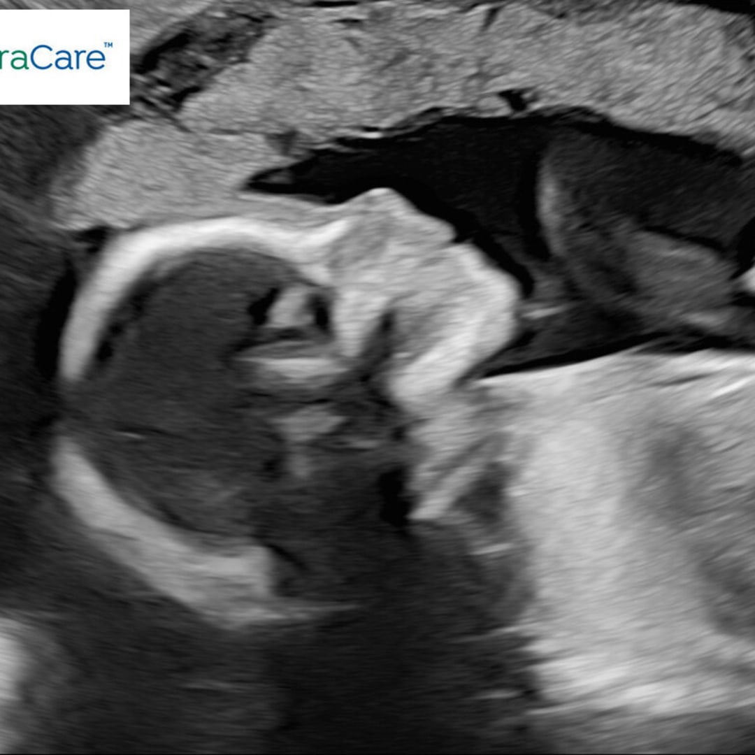 Photo shared by Emily for their Babylist baby registry.