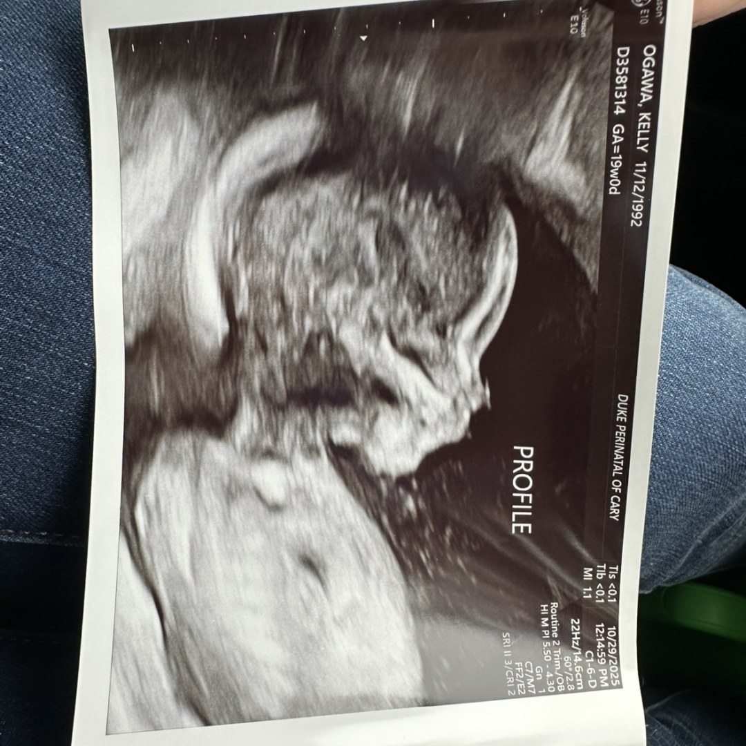 Photo shared by Kelly for their Babylist baby registry.