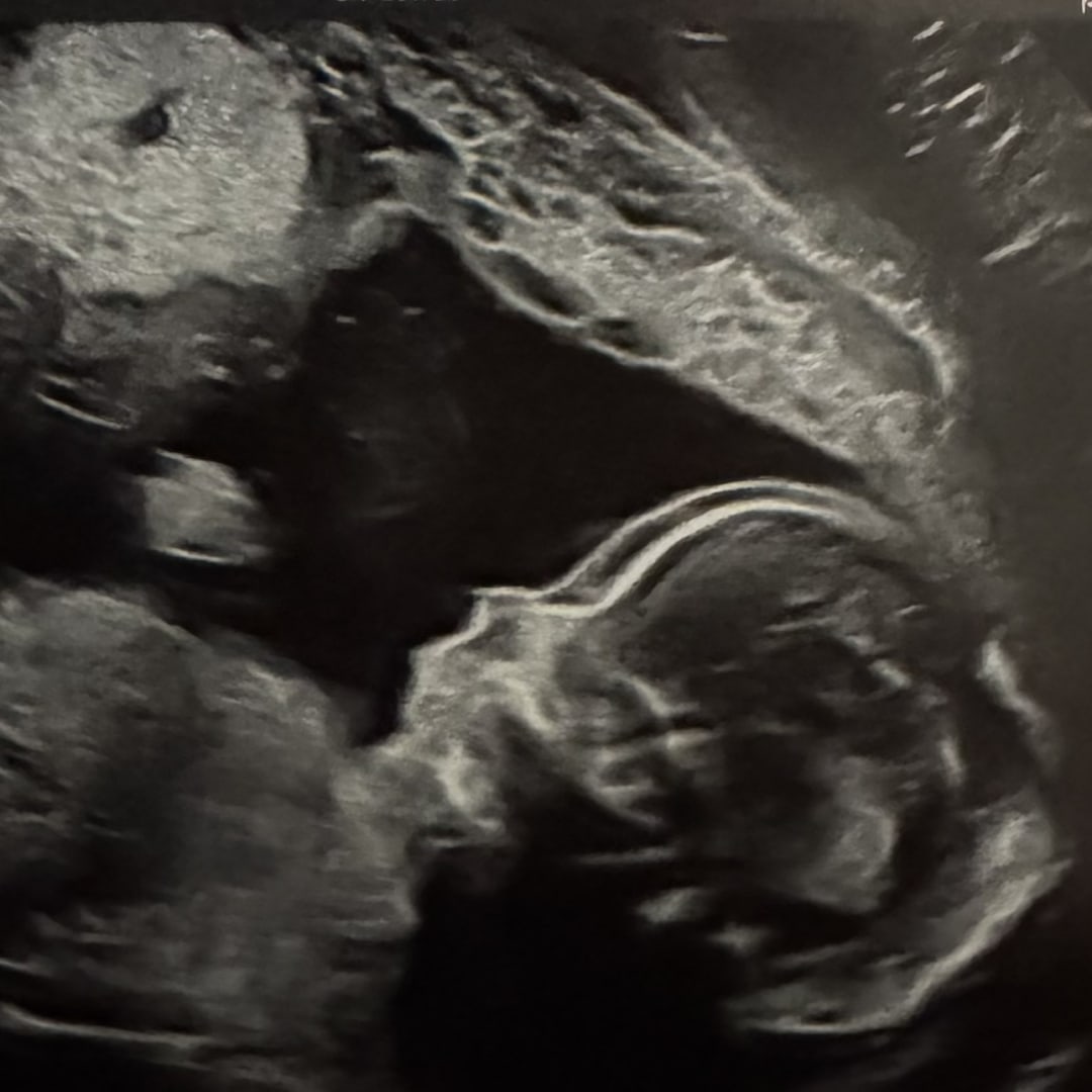 Photo shared by Kailey for their Babylist baby registry.