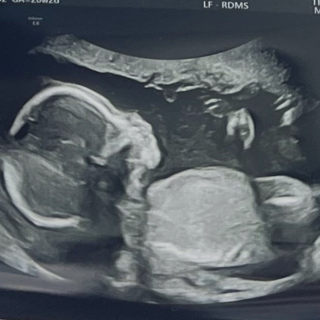 Photo shared by Ashley for their Babylist baby registry.