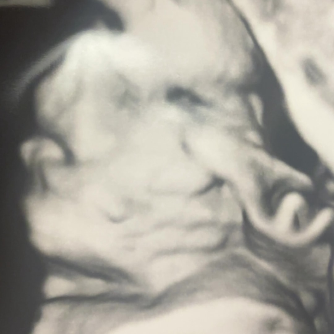 Photo shared by Grayson for their Babylist baby registry.