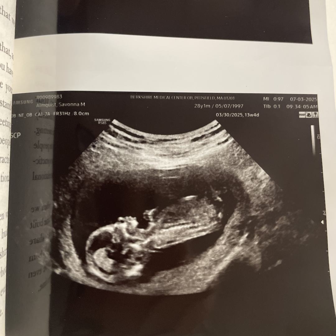 Photo shared by Savonna for their Babylist baby registry.