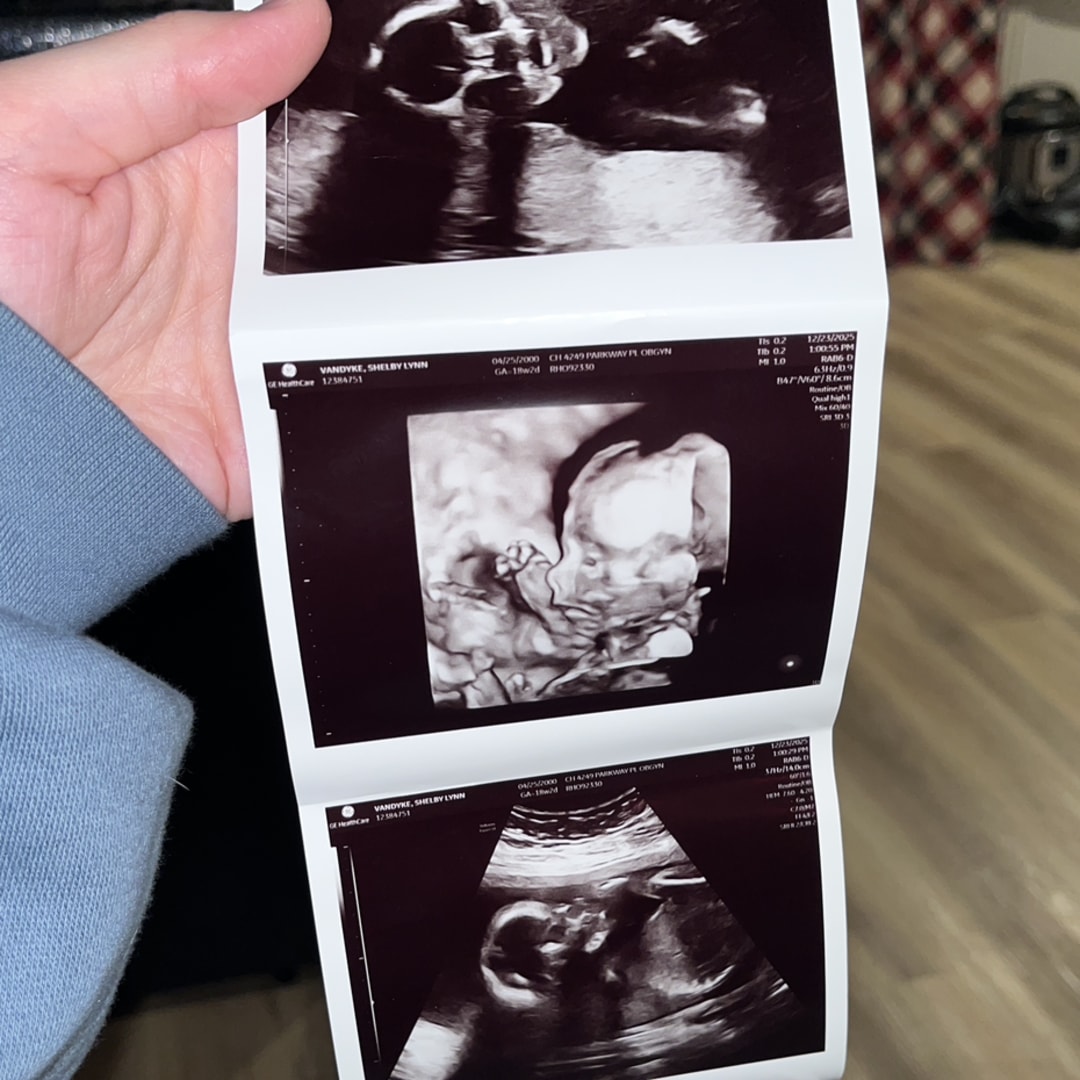 Photo shared by Shelby for their Babylist baby registry.