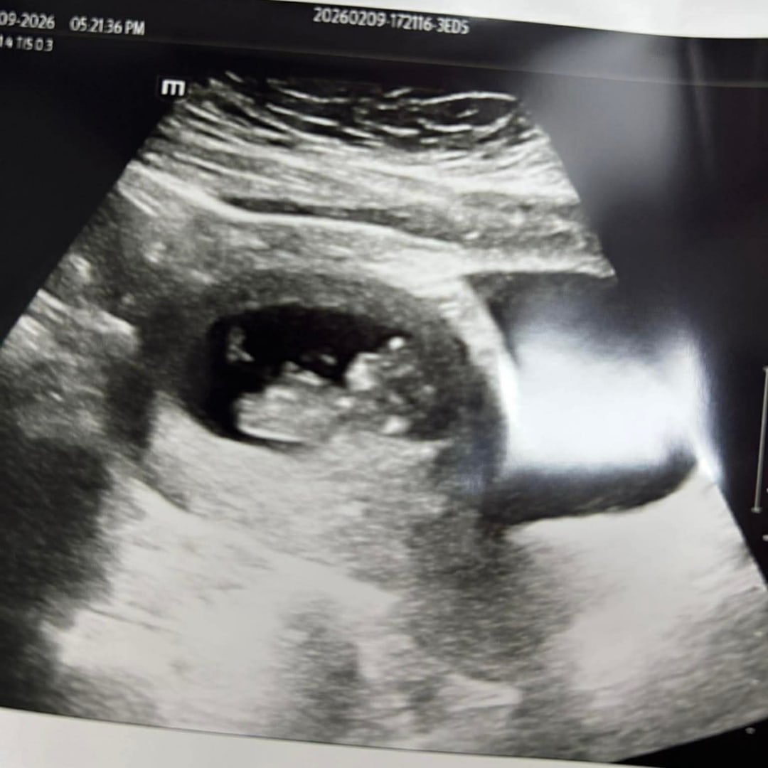 Photo shared by Ally for their Babylist baby registry.