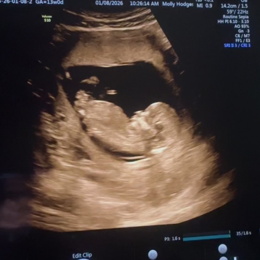 Photo shared by Emylie for their Babylist baby registry.