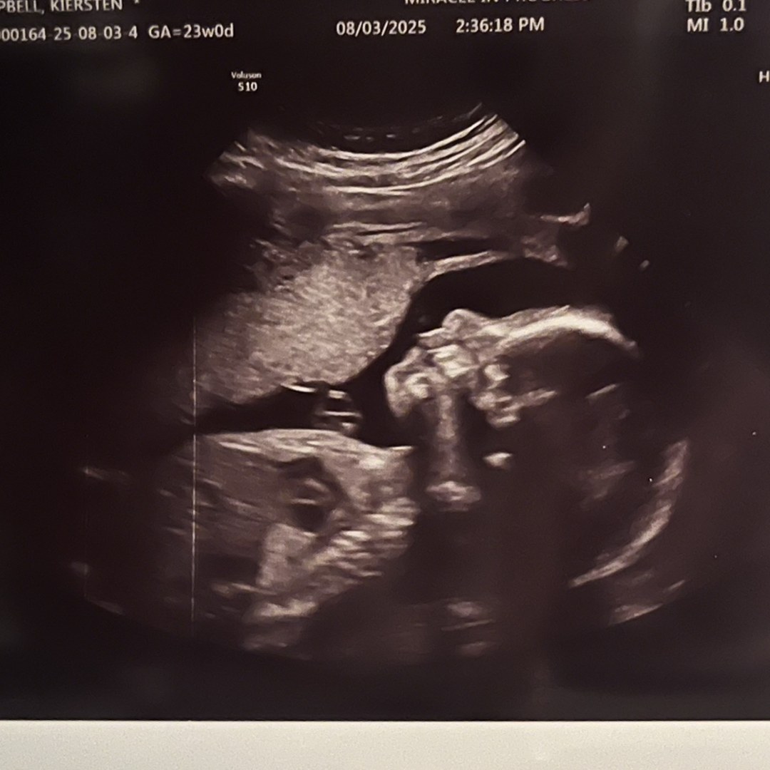 Photo shared by Kiersten for their Babylist baby registry.