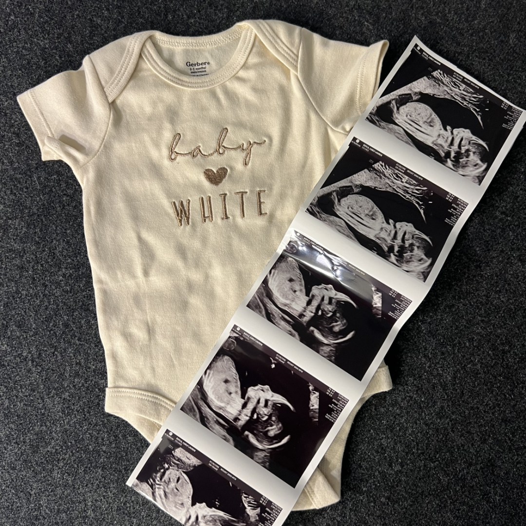 Photo shared by Carly for their Babylist baby registry.