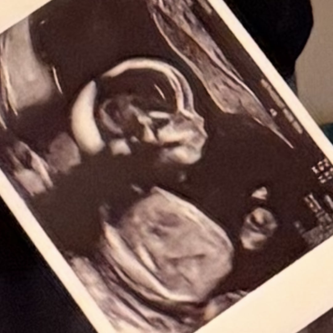 Photo shared by Grace for their Babylist baby registry.