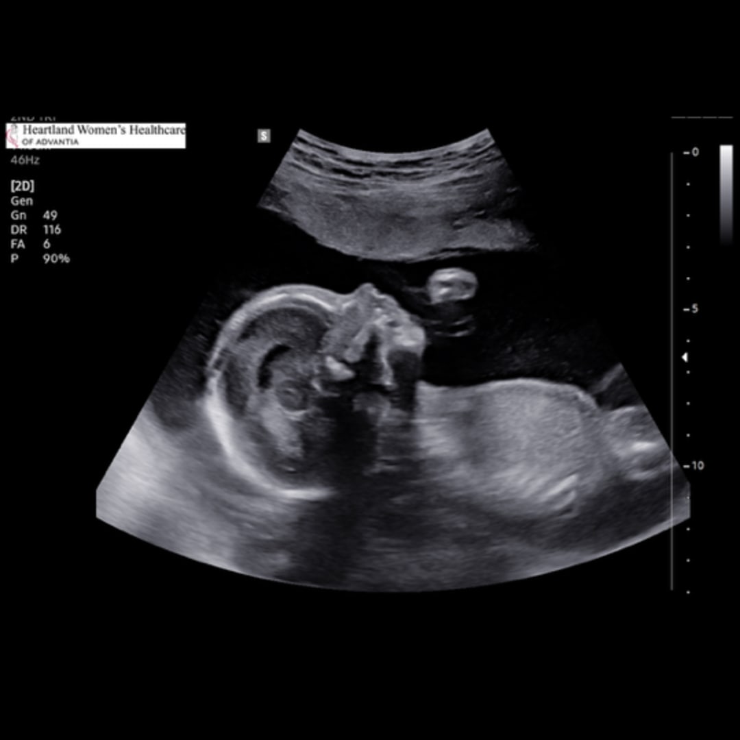 Photo shared by Faylea for their Babylist baby registry.