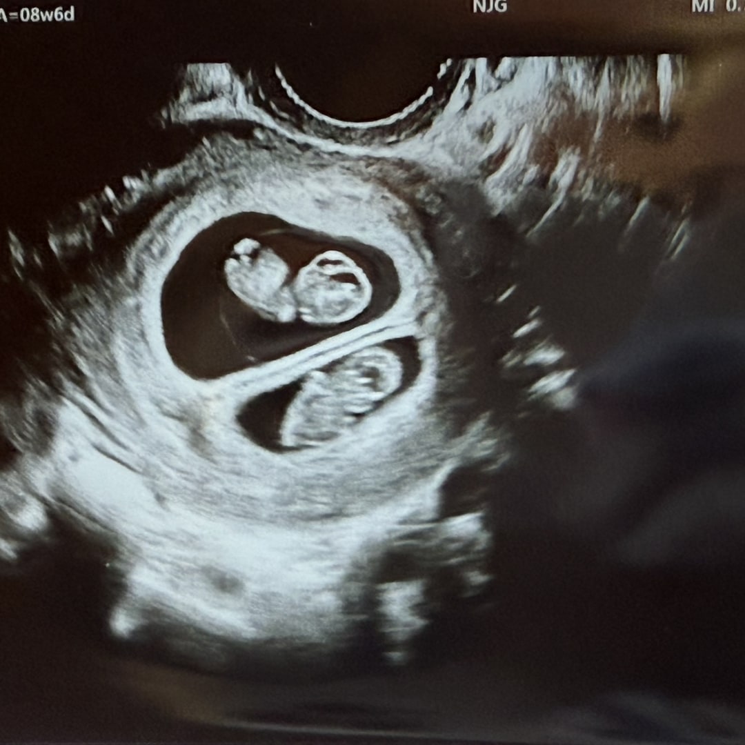 Photo shared by Kelly for their Babylist baby registry.