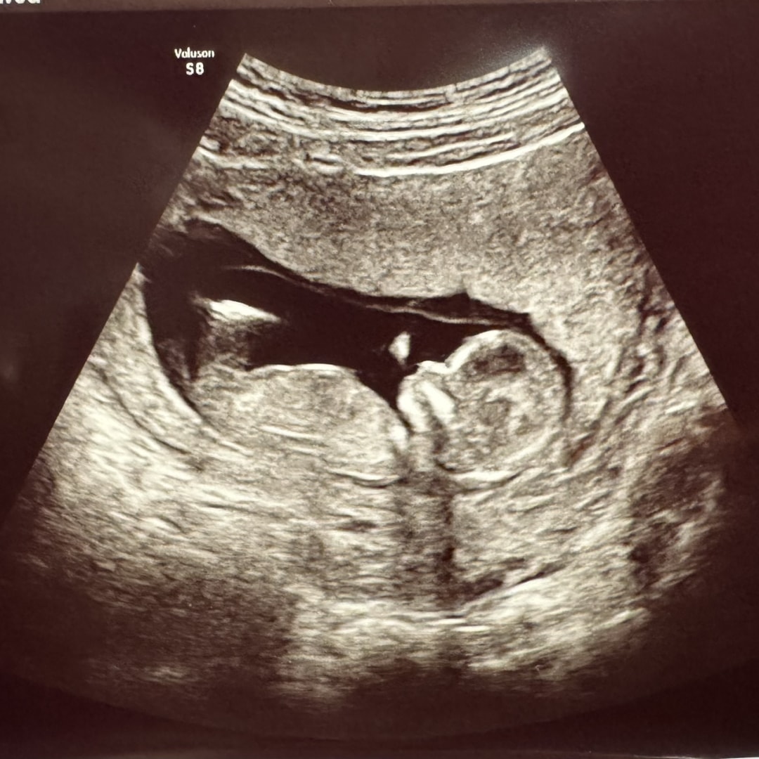 Photo shared by Ember for their Babylist baby registry.