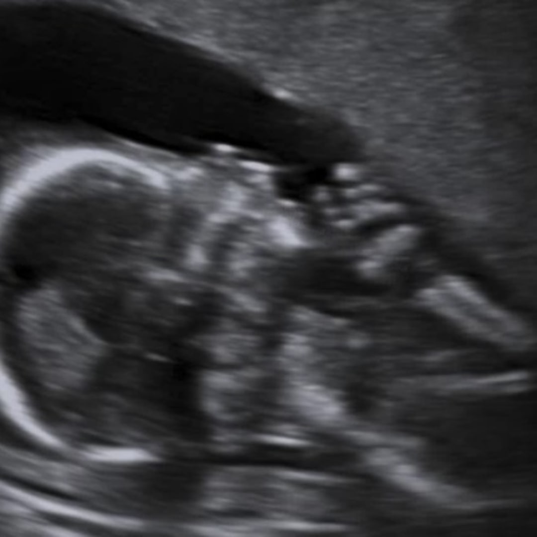 Photo shared by Beka for their Babylist baby registry.