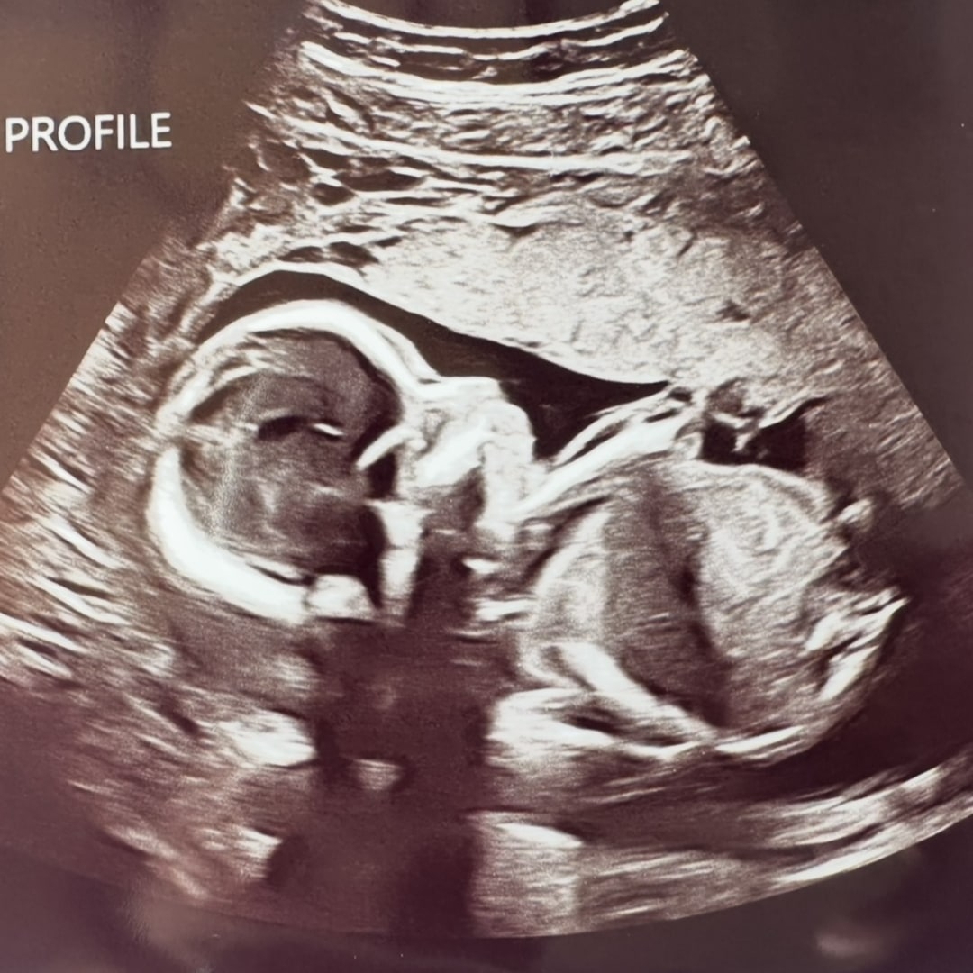 Photo shared by Deyna for their Babylist baby registry.