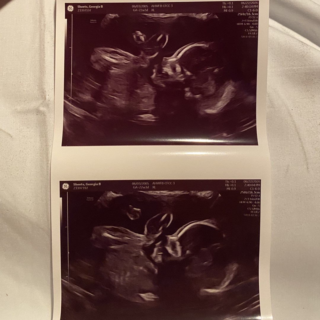 Photo shared by Georgia for their Babylist baby registry.
