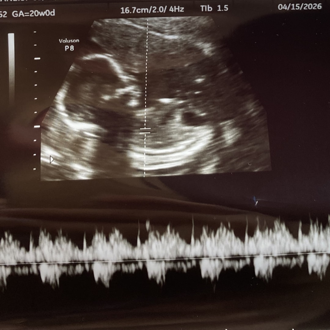 Photo shared by Yaneisi for their Babylist baby registry.