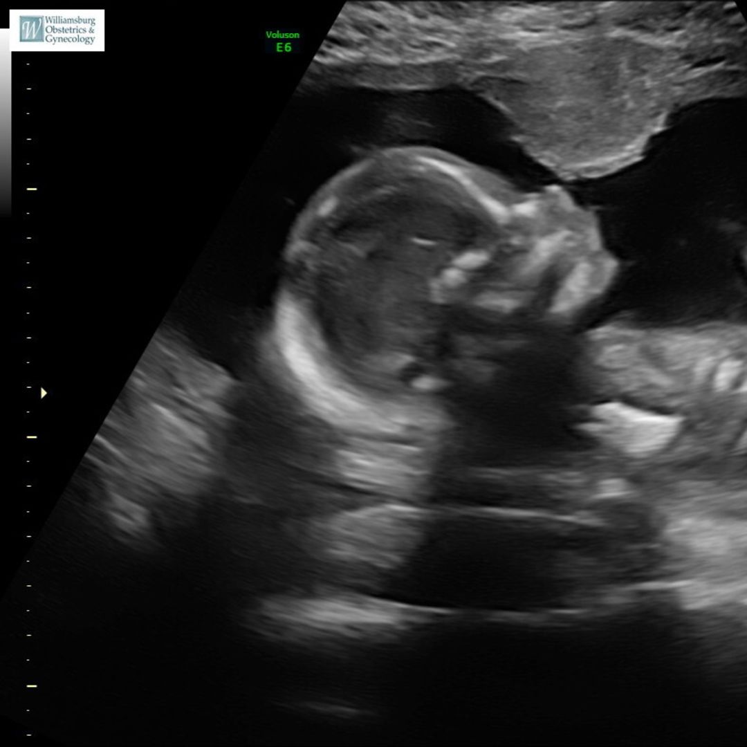 Photo shared by Hailee for their Babylist baby registry.