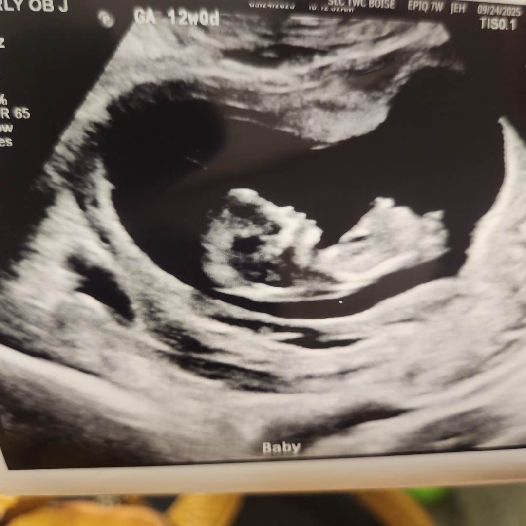Photo shared by Jenna for their Babylist baby registry.
