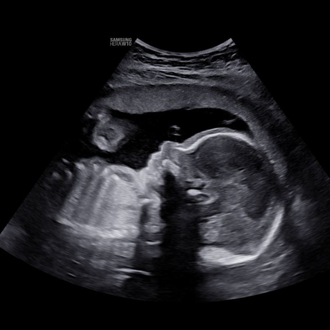 Photo shared by Breanna for their Babylist baby registry.