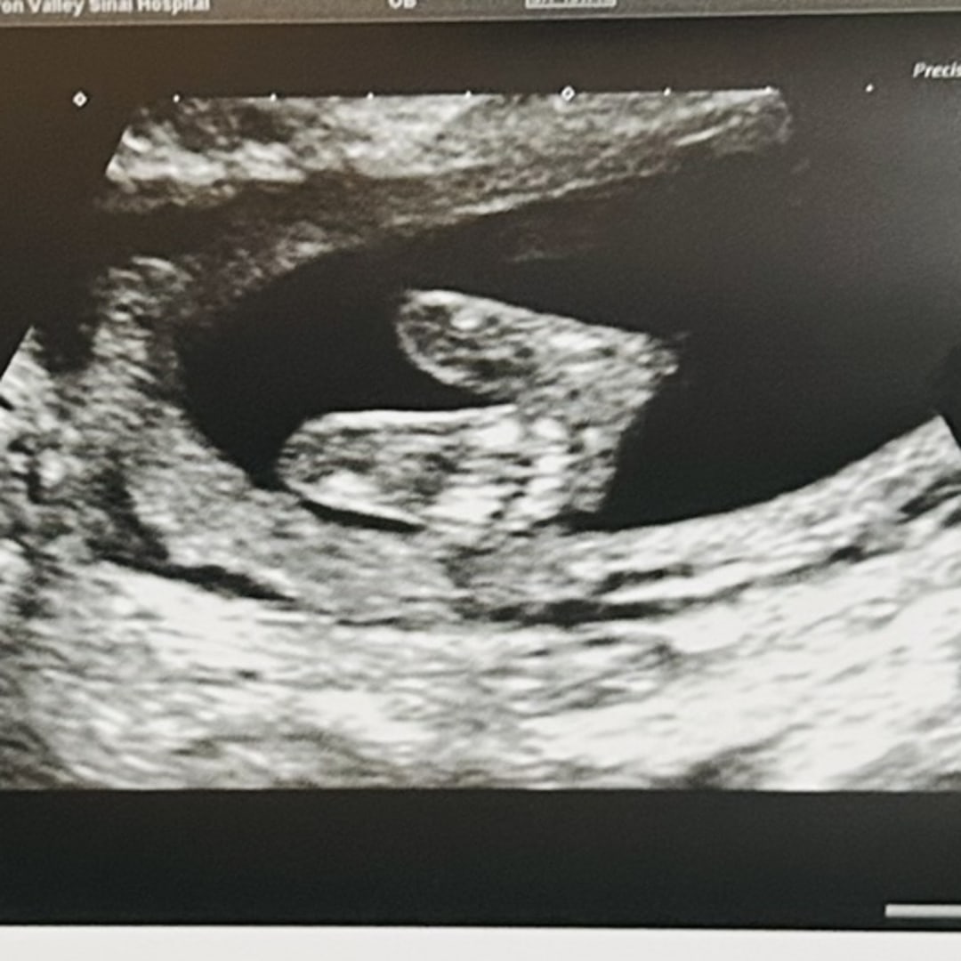 Photo shared by Cheyenne for their Babylist baby registry.