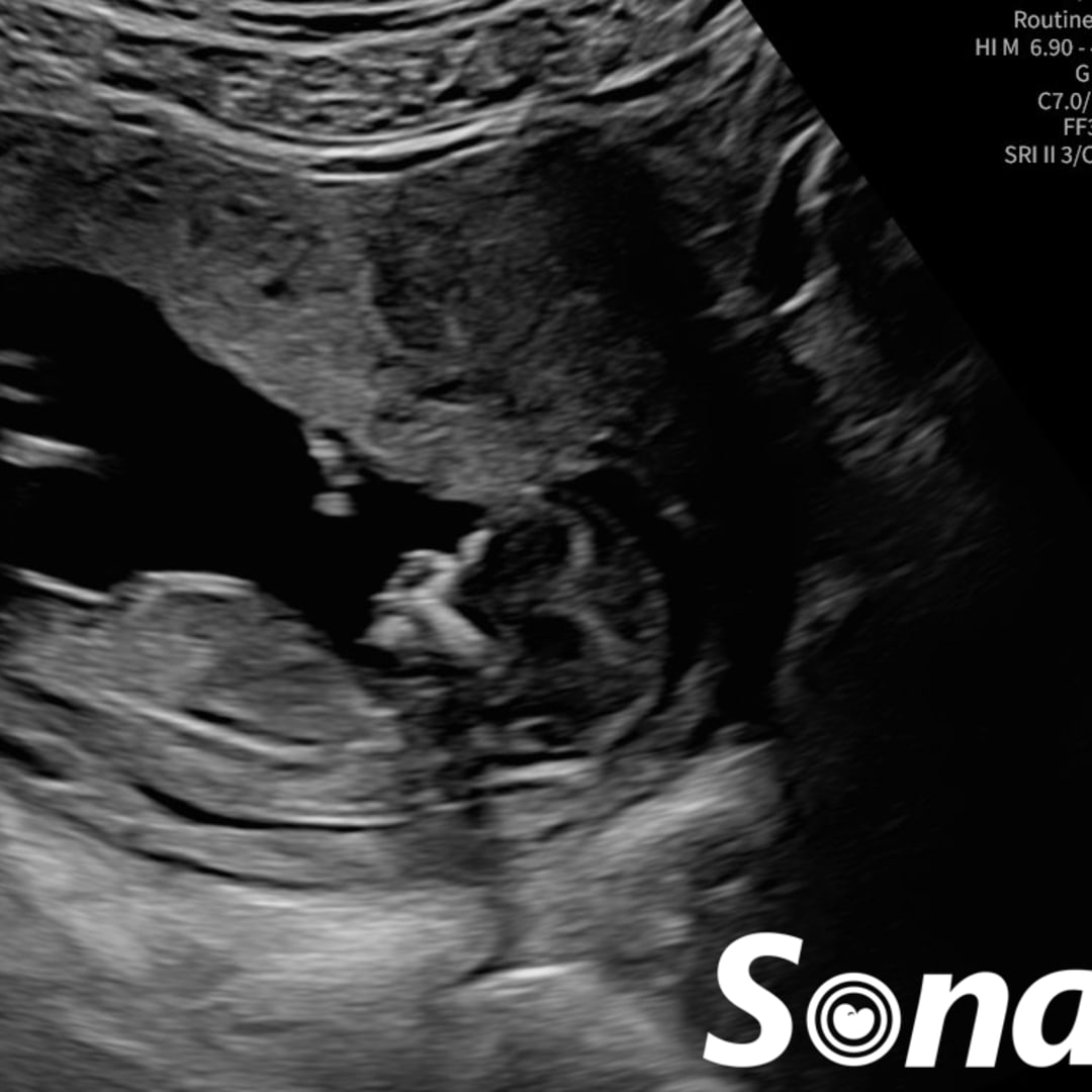 Photo shared by Jesse for their Babylist baby registry.