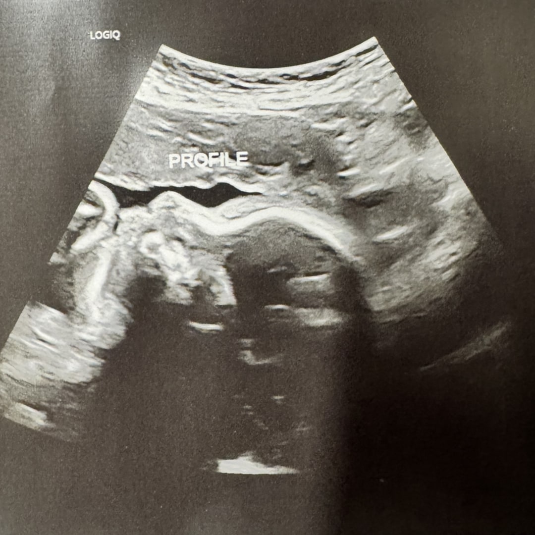 Photo shared by Chelsea for their Babylist baby registry.