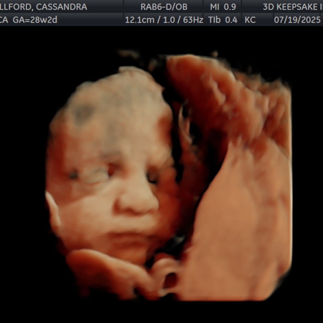 Photo shared by Cassandra for their Babylist baby registry.