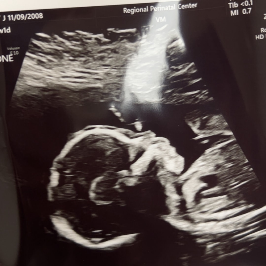 Photo shared by Emily for their Babylist baby registry.