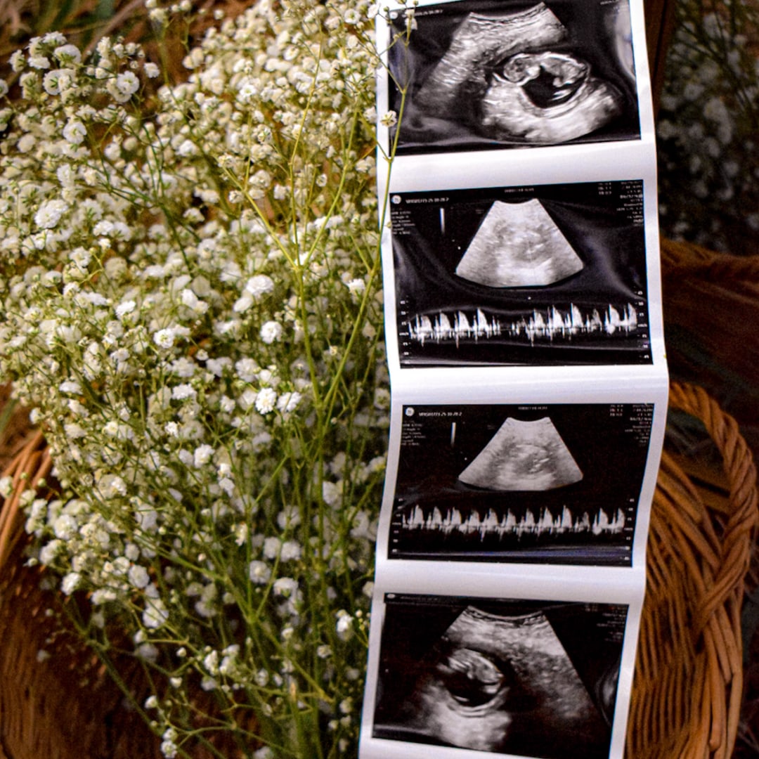 Photo shared by Regan for their Babylist baby registry.