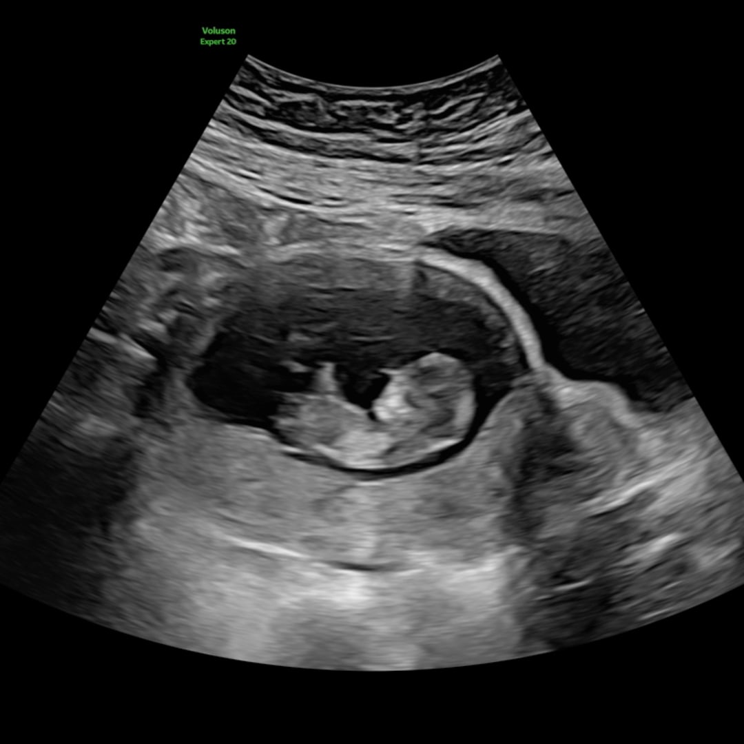 Photo shared by Catessa for their Babylist baby registry.
