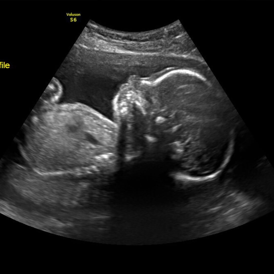 Photo shared by Shelby for their Babylist baby registry.