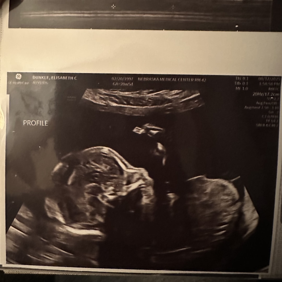 Photo shared by Elisabeth for their Babylist baby registry.