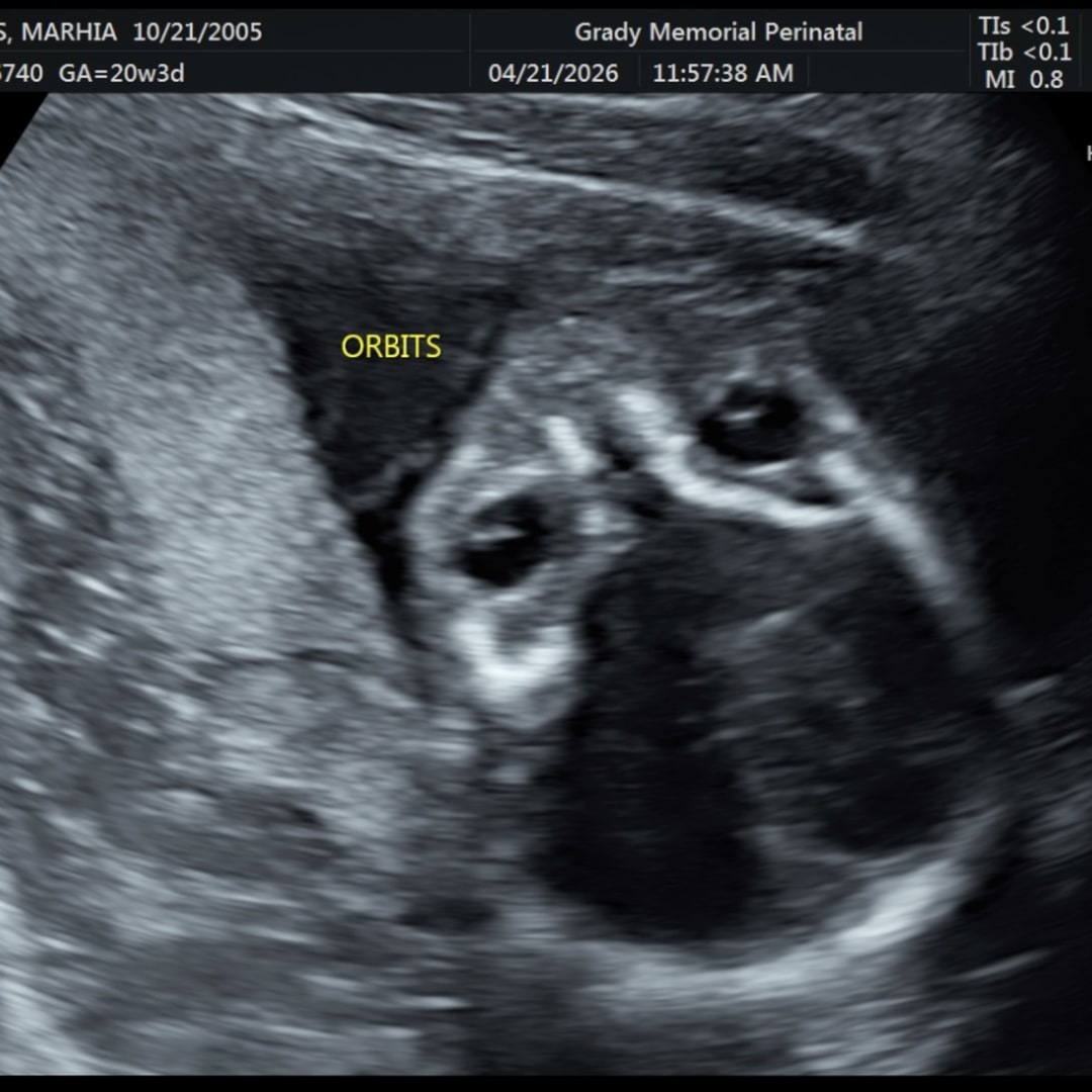 Photo shared by Marhia for their Babylist baby registry.