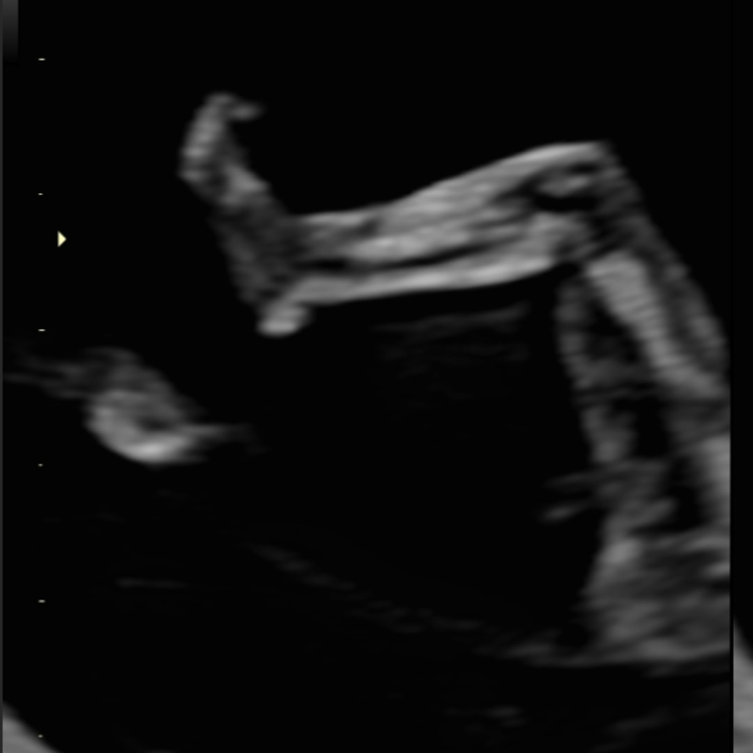 Photo shared by Aaliyah for their Babylist baby registry.