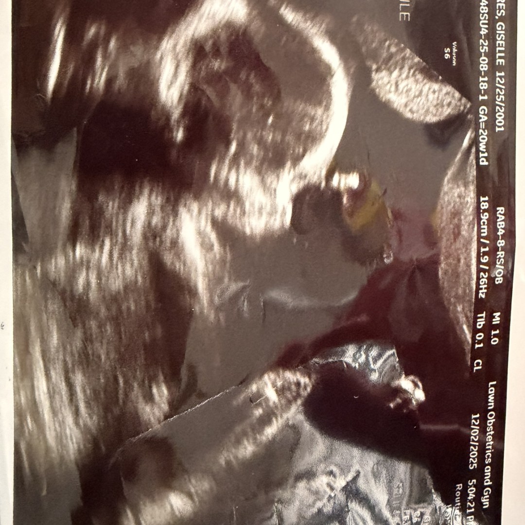 Photo shared by Giselle for their Babylist baby registry.